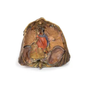 3D Printed Thorax with Heart and Vessels