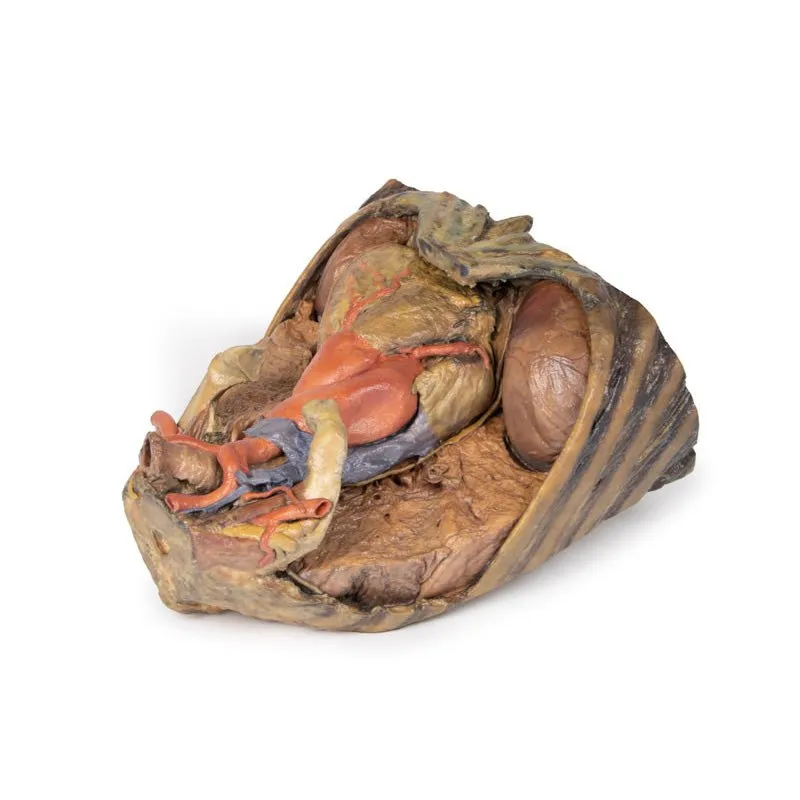 3D Printed Thorax with Heart and Vessels