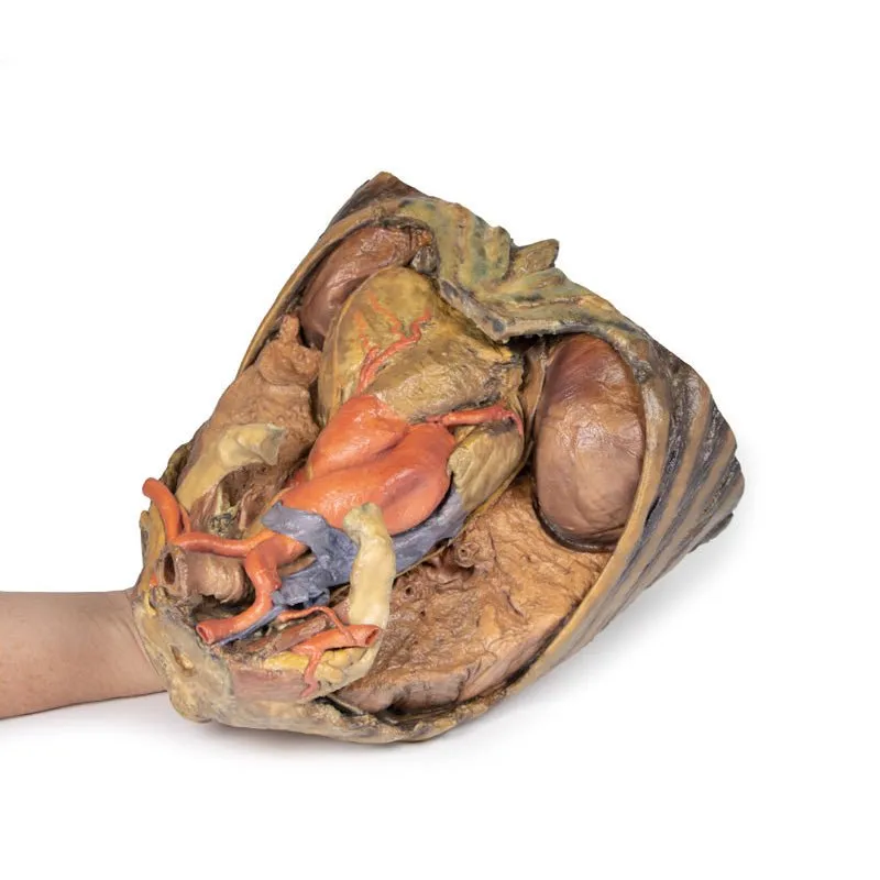 3D Printed Thorax with Heart and Vessels